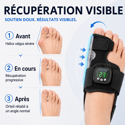 AEXZR® Nexalign Pro — Correcteur d'oignon EMS