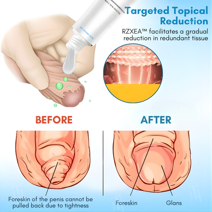 RZXEA™ Gel d'Élasticité du Prépuce : Retrouvez votre longueur d'avance, relancez votre vitalité.