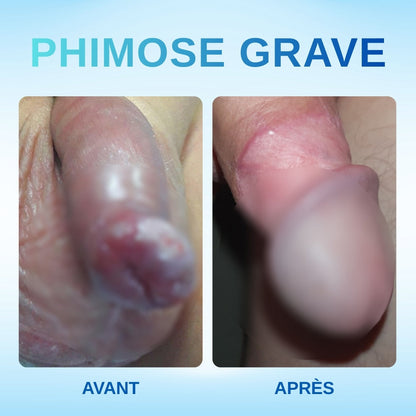 🛡️RZXEA™ Gel Correcteur de Prépuce Redondant -🌟 Solution Naturelle et Efficace pour Réduire💪
