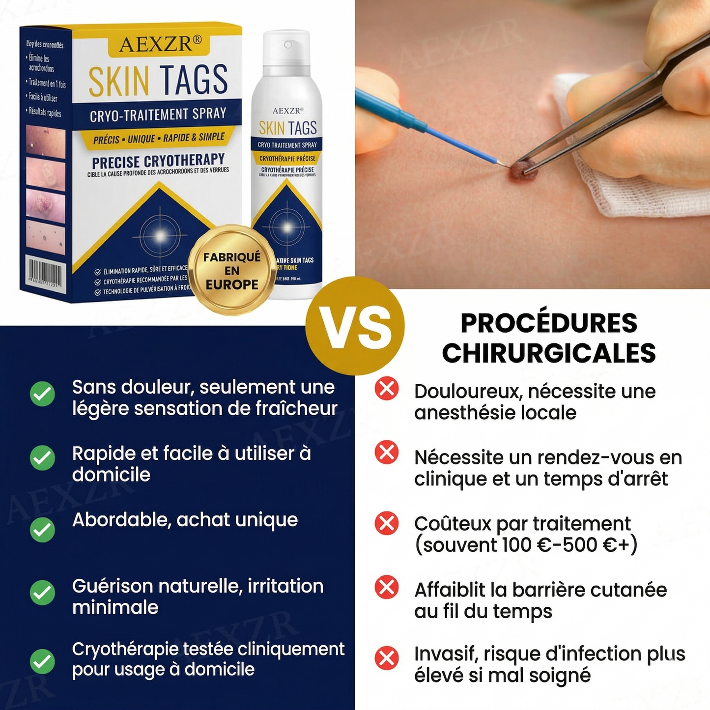 AEXZR® Spray de traitement cryogénique pour verrues et kératoses: Élimination rapide des verrues et de la kératose – Résultats visibles en 7 jours ✨