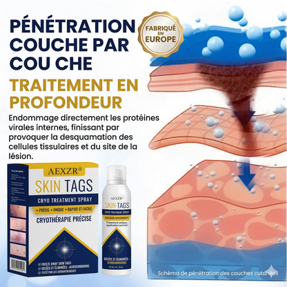 AEXZR® Spray de traitement cryogénique pour verrues et kératoses: Élimination rapide des verrues et de la kératose – Résultats visibles en 7 jours ✨