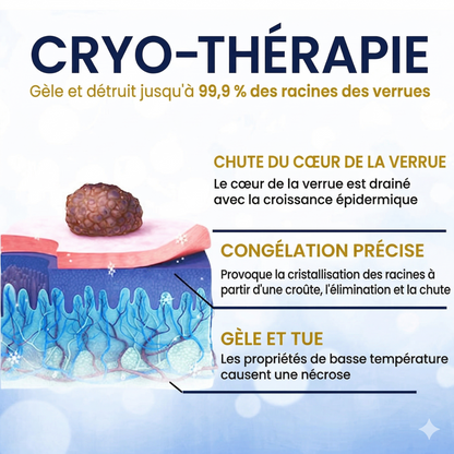 AEXZR® Spray de traitement cryogénique pour verrues et kératoses: Élimination rapide des verrues et de la kératose – Résultats visibles en 7 jours ✨
