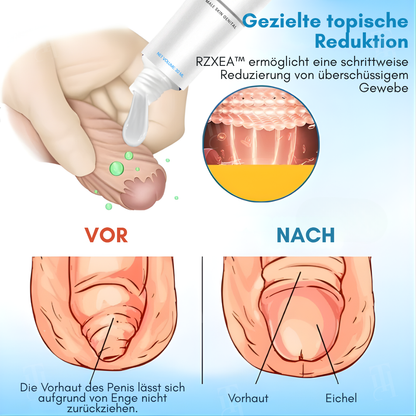 ⚡ RZXEA™ Gel d'Élasticité du Prépuce : Retrouvez votre longueur d'avance, relancez votre vitalité.