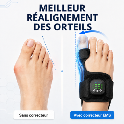 AEXZR® Nexalign Pro — Correcteur d'oignon EMS