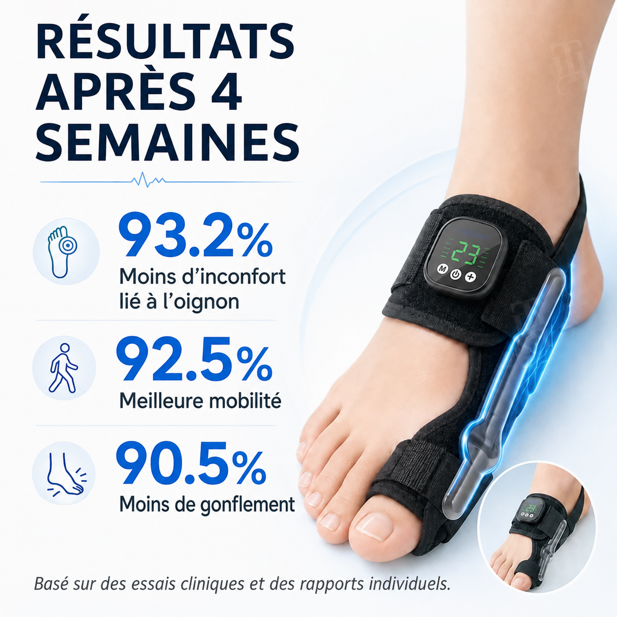 AEXZR® Nexalign Pro — Correcteur d'oignon EMS